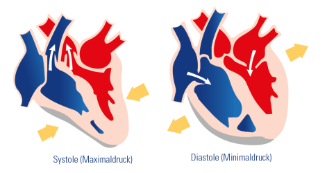 Zwei unterschiedliche Zeichnungen eines Herzens: eine im Systole und die andere im Diastole.